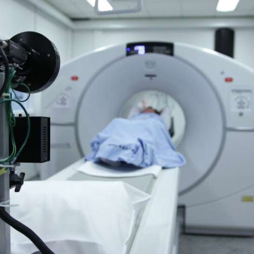 CT scan best at predicting heart disease risk in middle age