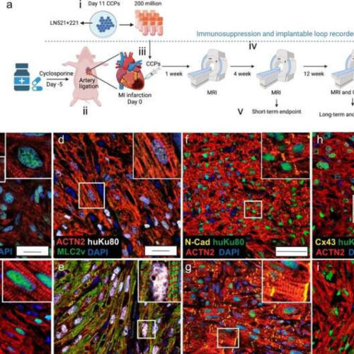 Researchers develop promising stem cell-based regenerative therapy for heart disease