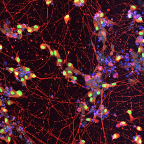 Parkinson’s disease drug ropinirole safely slows the progression of amyotrophic lateral sclerosis, finds clinical trial