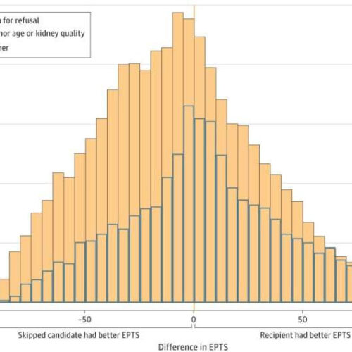 ‘List diving’ skips top candidates awaiting donor kidneys, reveals new research