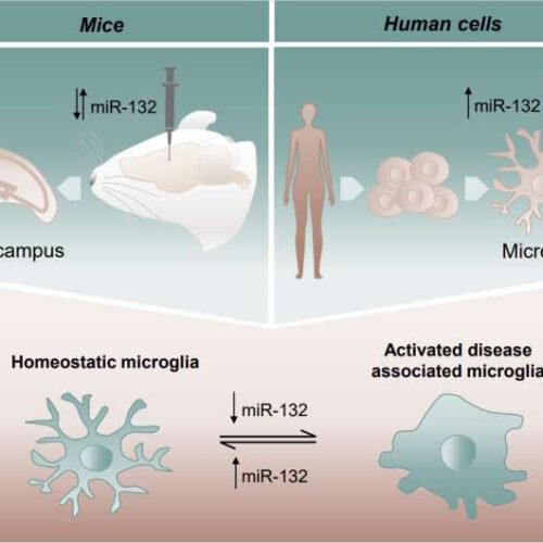 Research reveals ultra small molecule as a potential new target for Alzheimer’s disease