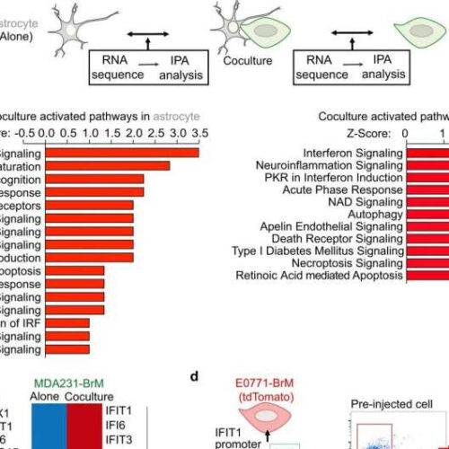 Study gives new insight into how cancer metastasizes to the brain