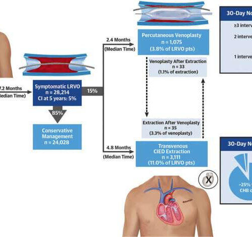 Study finds common complication of pacemakers four times higher than previously thought