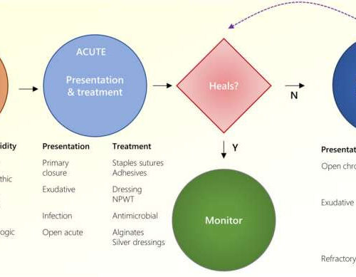 Breakthrough treatments for accelerated wound healing summarized