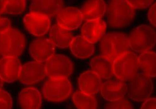 Treatment found to reduce progression of rare blood cancer by 74%