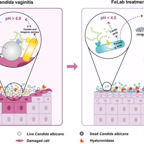 Nanozyme hydrogel: A breakthrough solution for Candida vaginitis treatment