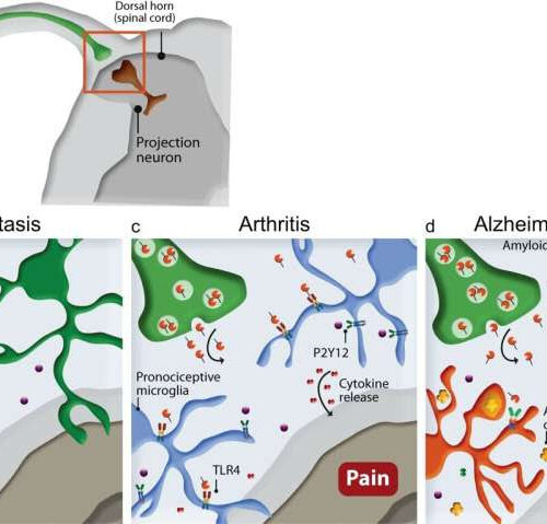 Mouse study suggests pain not perceived in the same way in people with Alzheimer’s disease