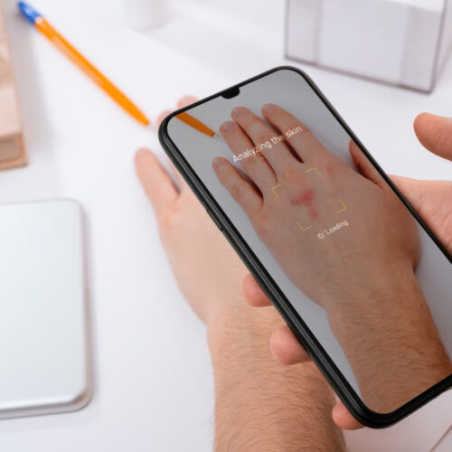 You can now use your phone to ID skin conditions