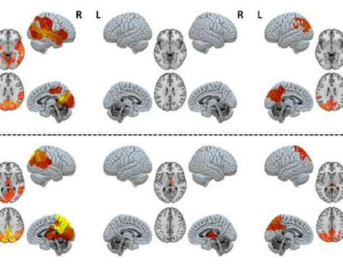 Brain modelling used to identify necessary circuits of consciousness