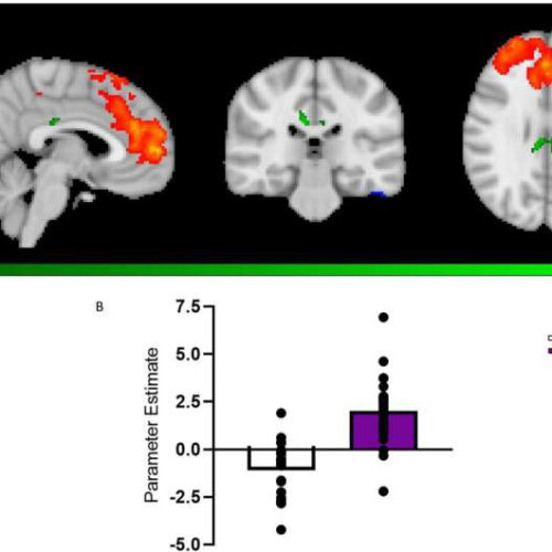 Serotonin booster leads to increased functional brain connectivity, shows study