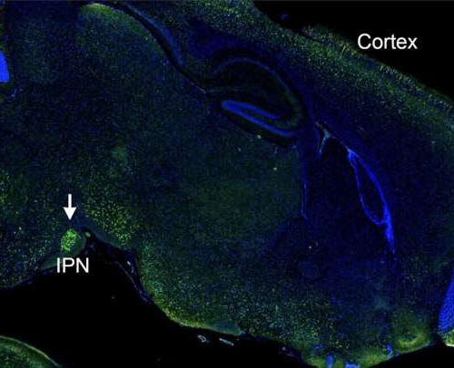 Intranasal CRISPR psychotropic reduces anxiety-related behavior in mice