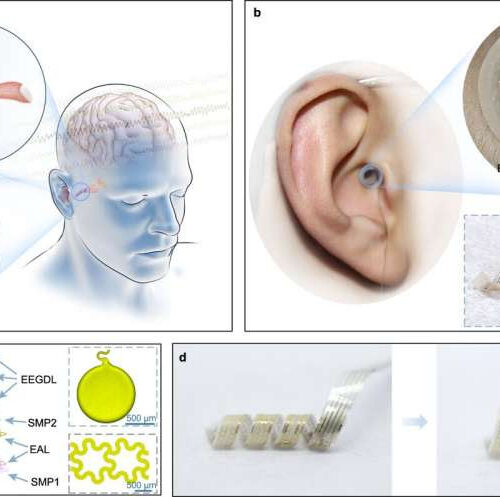 Spiral brain-computer interface slips into ear canal with no loss of hearing