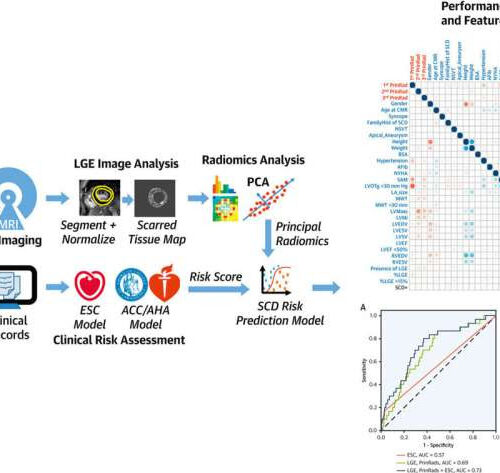 AI can improve predictions of sudden cardiac death in patients with common heart condition