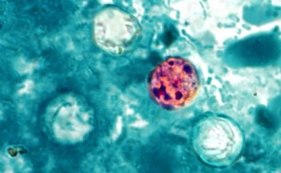 More than 100 infected in new outbreak from Cyclospora; source under investigation