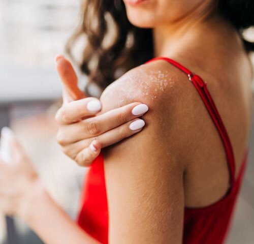 Here’s What You Should Do Immediately After You Get A Sunburn