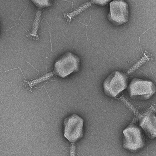 Bacteria-hunting viruses help diagnose and treat UTIs
