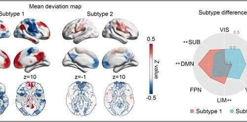 Brain imaging-based biomarker of depression identified