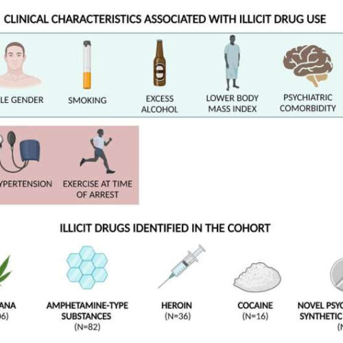 Illicit drug use is involved in nearly one in three sudden cardiac deaths in young adults