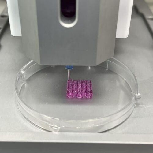 3D bioprinting technology to be used for removing cancer cells