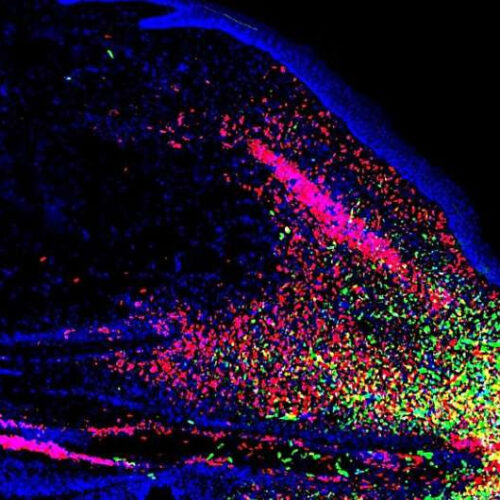 Researchers unlock mystery of cartilage regeneration in lizards, insight into osteoarthritis-damaged cartilage