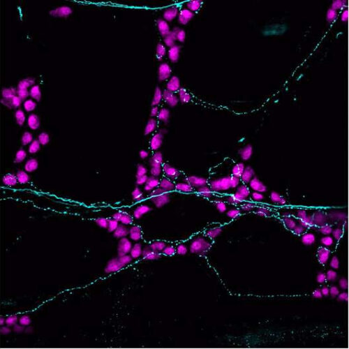 How sensory neurons impact the gut