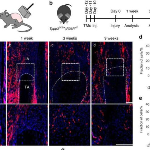 New insights into heterotopic ossification: Progenitor cells play a key role in aberrant bone formation