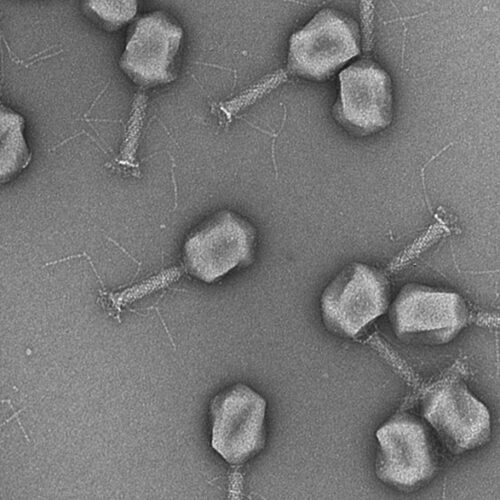 Bacteriophages to Diagnose and Treat Bladder Infections