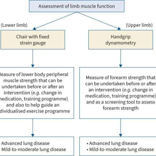 New international guidelines for functional exercise testing will improve cystic fibrosis treatment