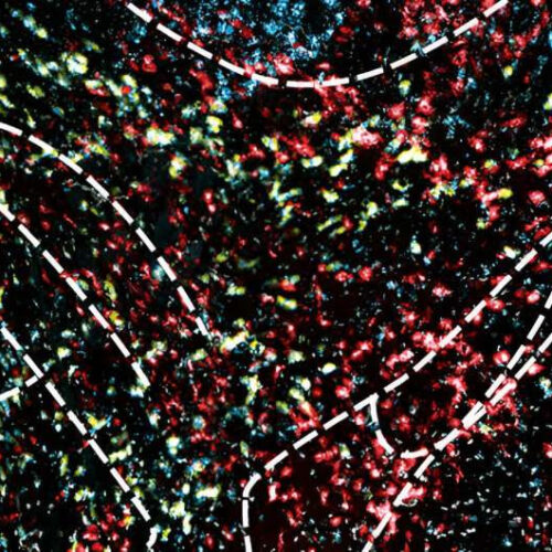 Dopamine control: Turning off one ion channel made mice smarter. Turning off another made them more motivated