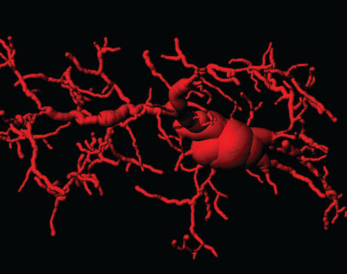 How immunity contributes to ageing and neurodegeneration