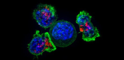 Scientists Discover a New, Unexpected Way That Cancer Cells Spread