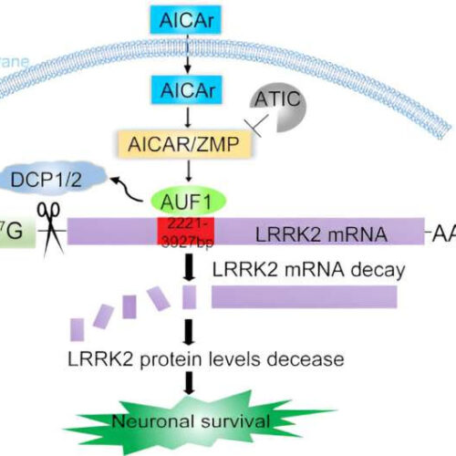 Researcher identifies key mechanism in Parkinson’s disease