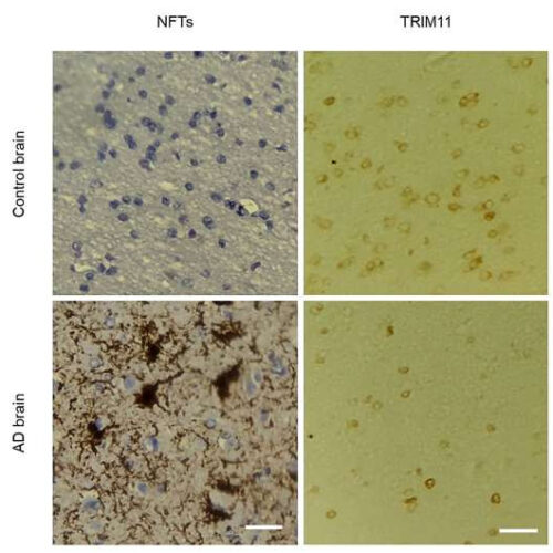 Tau-regulating protein identified as a promising target for developing Alzheimer’s disease treatment