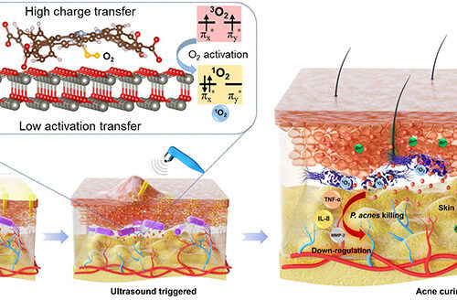 Microneedle Patch for Antibiotic-Free Acne Treatment