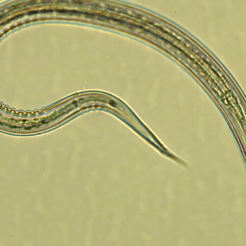Hookworms successfully prevent type 2 diabetes in human trial