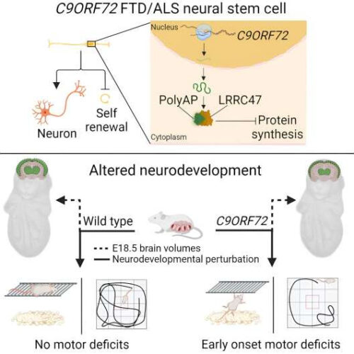 ALS and frontotemporal dementia show origins in utero, according to new study