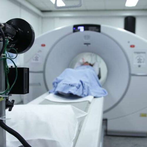 MRI scans improve prostate cancer diagnosis in screening trial