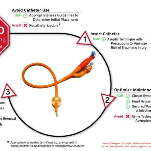 Alternatives to indwelling urinary catheters help patients avoid infections and urethral trauma