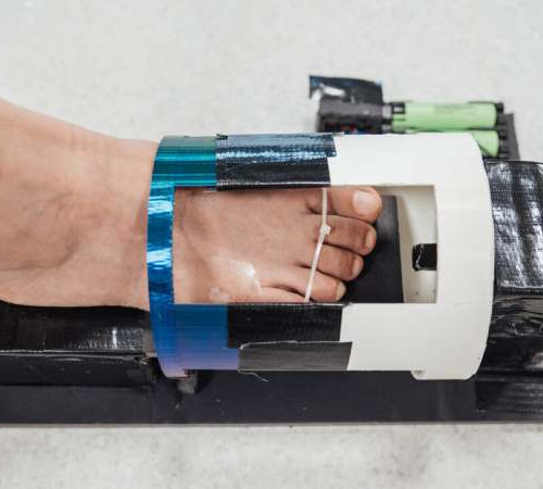 Scientists develop innovative magnetic gel that heals diabetic wounds three times faster