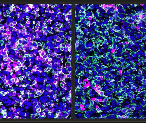 Study finds carcinogen exposure makes cancer cells more susceptible to immune attack