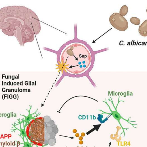 Brain fungal infection produces Alzheimer’s disease-like changes, says new study