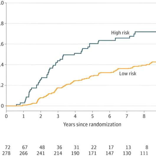 Prostate-specific antigen failure risk factors in nonmetastatic unfavorable-risk prostate cancer