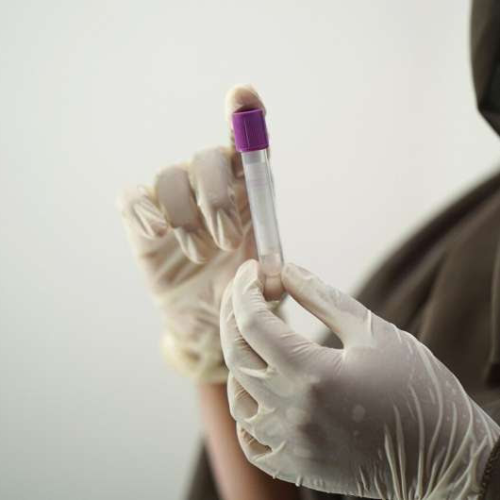 Simple blood test can help diagnose bipolar disorder