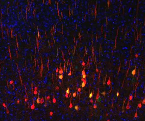 New biomarker predicts whether neurons will regenerate