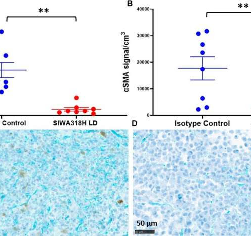 New antibody shows strong potential as treatment against pancreatic cancer