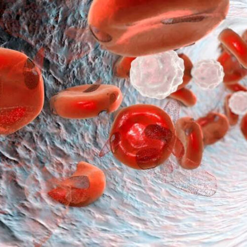 Testosterone efficacious for correcting anemia in middle-aged men
