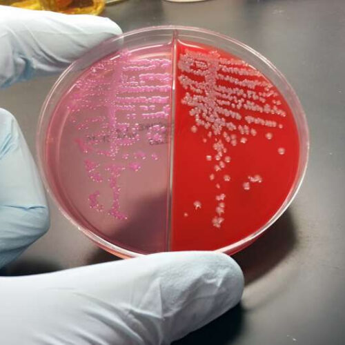 Resistant E. coli rises despite drop in ciprofloxacin use
