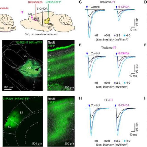 Repairing broken brain circuits may offer path to new Parkinson’s treatments