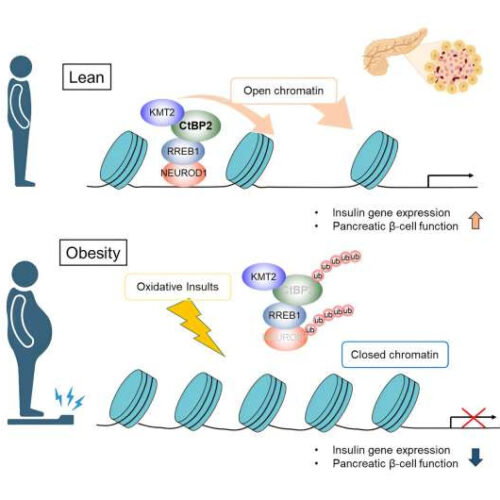 Unraveling the mechanism behind obesity-induced pancreatic β-cell dysfunction 