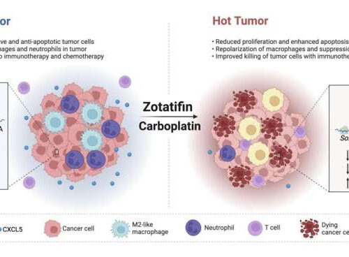 Protein eIF4A emerges as a potential Achilles’ heel for triple-negative breast cancer